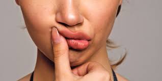 With damaged, red skin i think it's easier for acne to keep coming back. How To Treat Popped And Unpopped Pimples How To Get Rid Of Acne