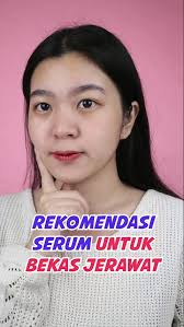 Ekstrak stroberi ini sangat efisien dalam mencerahkan kulit, termasuk hiperpigmentasi (bibir menghitam), dark spot, dan juga bekas luka. Review Jujur Serum Hanasui Anti Acne Storie