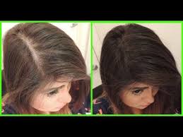 وصفة خطيرة لغزارة الشعر وزيادة طوله وتقويته وتكثيفه علاج تساقط الشعروالتقصف قبل العيد Youtube