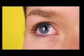 Baghali Why Can T See Our Eye At Night Puffy Eyes Puffy Eyes Remedy Eye Care