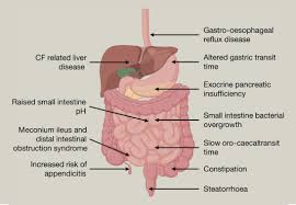 Formerly known as cystic fibrosis of the pancreas, this entity has increasingly been labeled simply cystic fibrosis. Gastrointestinal Complications Of Cystic Fibrosis Sciencedirect