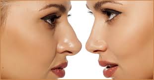 The use of protraction and retraction. What Type Of Nose Do I Have Quiz Quizony Com