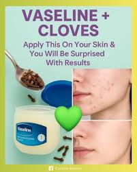 Ever tried the magic of Vaseline and clove? 😍 This powerful combo works  wonders for dry skin, scars, and irritation! Just mix these two ingredients  for a soothing, natural remedy that your