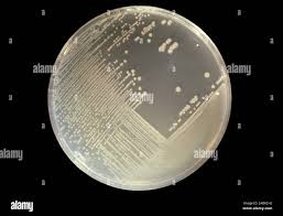Image result for Shigella