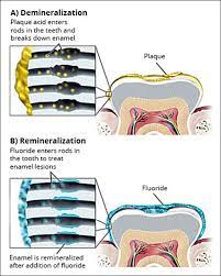 Interestingly, enamel is the hardest material produced by the human body. Fluoride S Mechanism Of Action Fundamentals Of Dentifrice Oral Health Benefits In A Tube Continuing Education Course Dentalcare Com