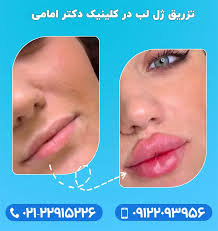 همه چیز در مورد تزریق ژل لب - کلینیک زیبای دکتر ترانه امامی