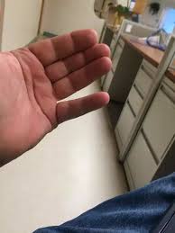 Your finger may bend or straighten with a snap — like a trigger being pulled and released. Why Can T I Move My Ring Fingers And Pinkies Independently From Each Other Quora