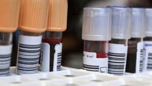 Le jour de la prise de sang. Bilan Sanguin Comprendre Les Resultats Traitements Soins Essentiel Sante Magazine