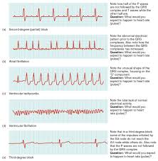 Image result for Sodium Channel Blocker