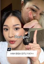 Keajaiban Serum Wajah Lacoco: Before-After yang Mengejutkan!