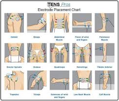 Pin On Tens Machine Placement