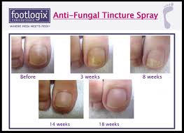 They are easy to use without a lot of mess or fuss. Footlogix Nail Tincture Spray Nataya Beauty