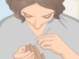 If you stay away from the plant or marine life that causes your skin to itch, the rash tends to go away on its own within a few days to a couple of weeks. How To Stop Your Cuticle Skin From Peeling With Pictures