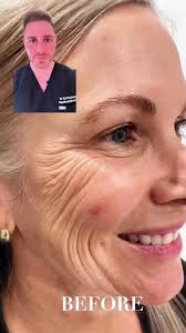 Are you still worried about wrinkles? Try this#Korean#skincare#koreanp...