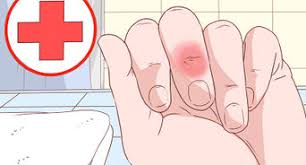 First of all, don't grab the spines. 3 Ways To Remove Cactus Needles Wikihow