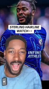 Raheem Sterling Hairline Transformation