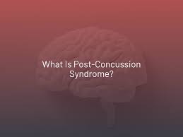 Image result for Postconcussion Syndrome