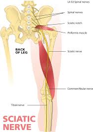 Image result for Sciatica