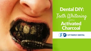 How to whiten teeth with braces? Diy Teeth Whitening With Activated Charcoal 1st Family Dental