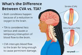 Bildergebnis für CVA
