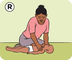 Tilt his head backward toward the sky. Cpr For Newborns And Babies In Pictures Raising Children Network