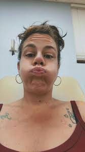 Dialysis and transplant preparation challenges