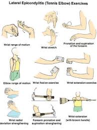 Lateral Epicondylitis Morphopedics Elbow Exercises Tennis Elbow Tennis Elbow Exercises