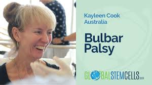 Image result for Progressive Bulbar Paralysis