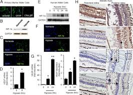 Maybe you would like to learn more about one of these? Hypoxic Retinal Muller Cells Promote Vascular Permeability By Hif 1 Dependent Up Regulation Of Angiopoietin Like 4 Pnas