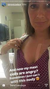 Stars doing their best impressions of looking good. Why Do Her Angry Mast Cells Look More Like A Tan Line Do They Really Flare Like That Cz Instastory 8 8 18 Illnessfakers
