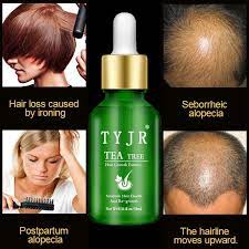If used correctly, tea tree oil will not cause hair loss! Tea Tree Essential Oil Essence Hair Essence Anti Hair Loss Treatment Hair Camp Liquid Hair Oil Hair Care Sets Aliexpress