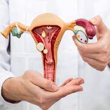 Endometriosi interna ed endometriosi esterna: Endometriosi Sintomi Diagnosi Cura Pazienti It