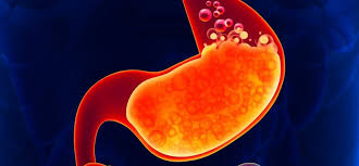 Ketahui perbedaan gastritis dan gastroenteritis. Gastritis Penyebab Gejala Diagnosis Pengobatan Doktersehat