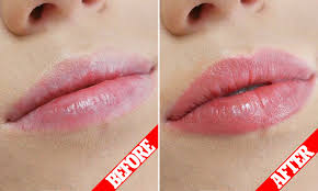 Why Blushing Is The New Lip Treatment Women Can T Get Enough Of Daily Mail Online
