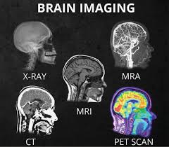 What is a pet scan? What S The Difference Between All The Different Head Scans X Ray Ct Mri Mra Pet Scan San Diego Brain Injury Foundation