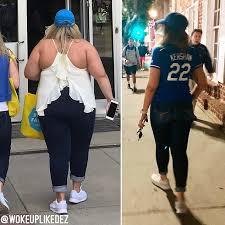 Desiree Mize shows off her 150lb weight loss of 150lbs in one year after  gastic bypass surgery