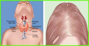 To summarize, dihydrotestosterone (dht) is an androgen sex hormone that contributes to hair growth, muscle gain, fertility, etc. Top 25 Best Hair Growth Hacks Men Women In 2021
