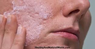 Just like hypertrophic scars, keloid scars are also raised scars. How To Get Rid Of Acne Scars Naturally