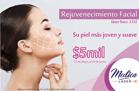 Médica láser Torreón hat in nije...