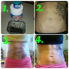 Lightens Stretch Marks Body Wraps Recipe Stretch Mark Remedies Diy Body Wrap
