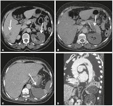 Radiologia Brasileira Cartas Ao Editor