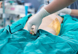 Best Hospital For Kidney Transplant In Kerala Urologist In Kozhikode Calicut