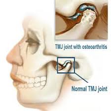 Pin On Posture Alinement