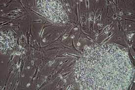For example, mouse somatic cells can be reprogrammed to ipscs, which are very similar to mouse escs ( takahashi and yamanaka, 2006 ). Scientists Grow Two New Stem Cell Lines In Animal Cell Free Culture