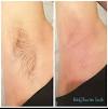 Female Armpit Wax