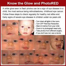 Other cns cancer warning signs are vision problems. World Eyecancer Hope On Twitter Knowtheglow On Photoredfriday Use This Technique To Check For Signs Of Child Eye Cancer Other Eye Disease Http T Co 9jcgueuy8i