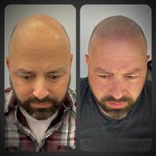 What are your thoughts