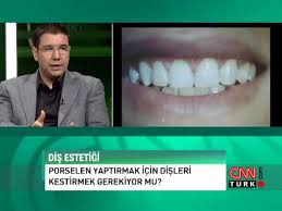 Sgk diş yaptırma ücreti ne kadar? Porselen Yaptirmak Icin Disleri Kestirmek Gerekir Mi Youtube