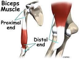 Distal Biceps Rupture