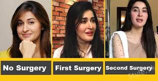 Check spelling or type a new query. 15 Pakistani Actresses Who Opted For Plastic Surgery Then And Now